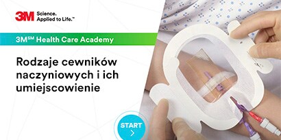 Rodzaje cewników naczyniowych i ich umieszczanie w różnych częściach ciała
