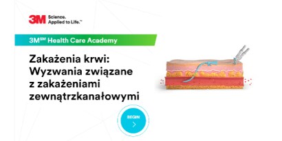 Zakażenia krwi: Wyzwania związane z zakażeniami zewnątrzkanałowymi

